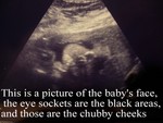 baby1