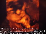 baby2