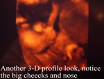baby3