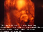 baby4