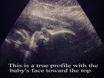 baby5